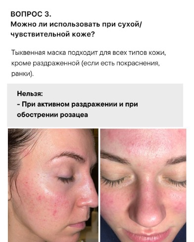 Изображение выглядит как Человеческое лицо, кожа, снимок экрана, ресницаКонтент, сгенерированный ИИ, может содержать ошибки.